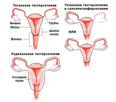 риск риск