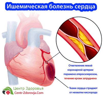 риск